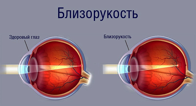 Диагностика
