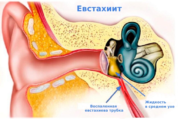 Симптомы
