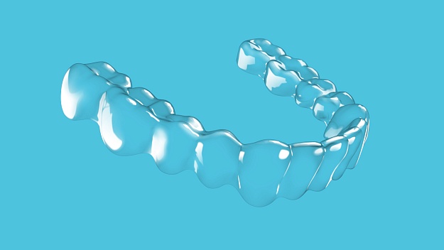 Элайнеры: ортодонтия, которая соответствует вашему ритму жизни