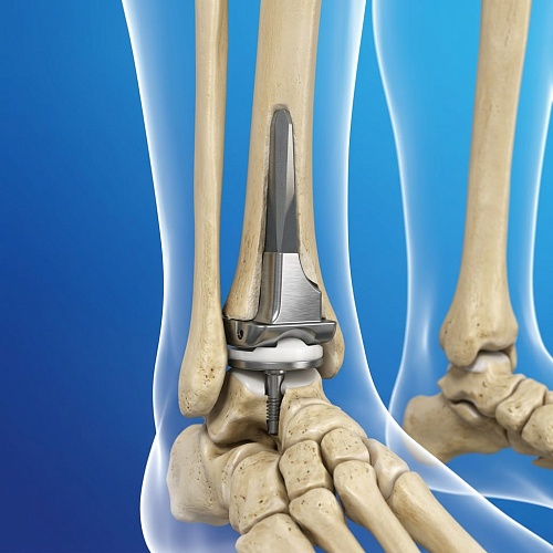 Как проходит операция