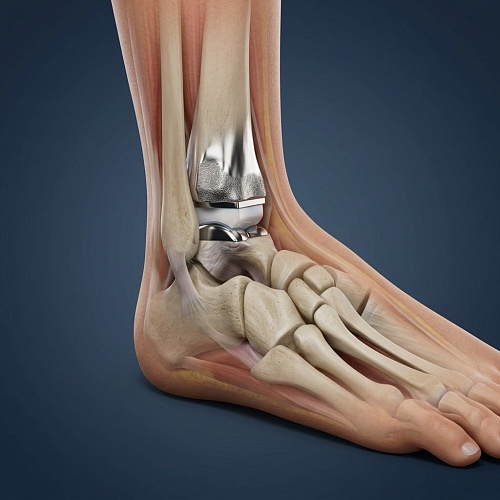 Показания и противопоказания