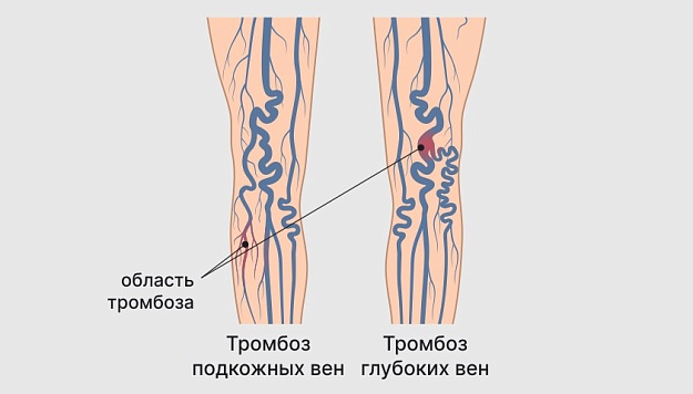 Причины