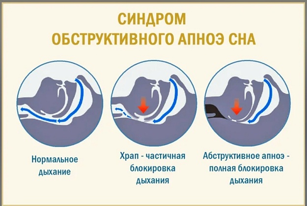 Профилактика