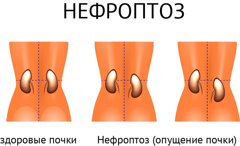 Причины