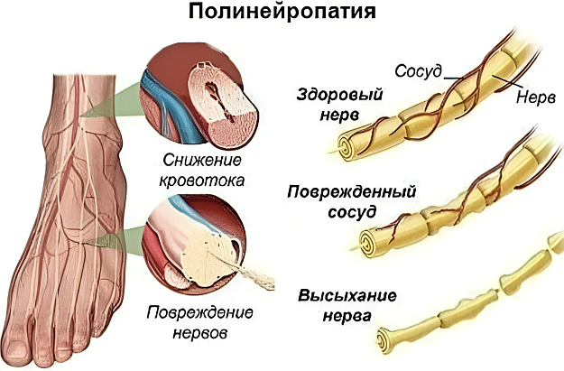 Диагностика 