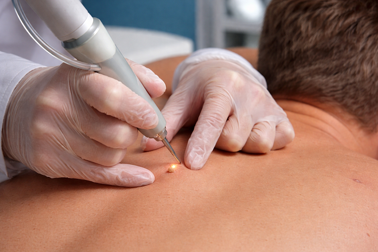 Как проходит лечение