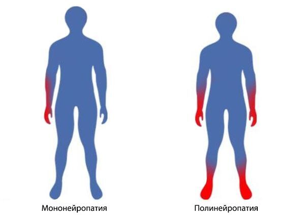 Симптомы