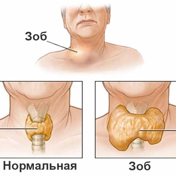 Причины заболевания