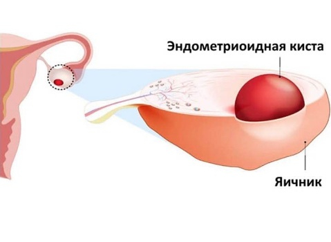 Симптомы