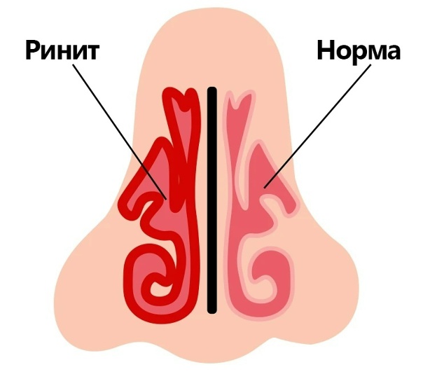Диагностические мероприятия